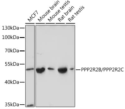 PPP2R2B Antibody