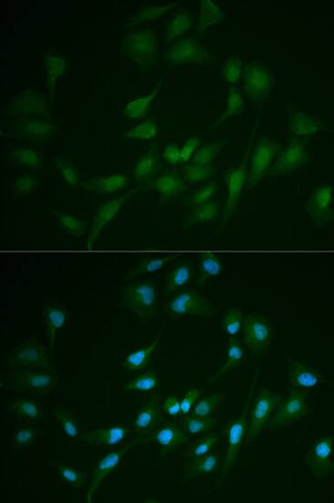 DNA Ligase I Antibody