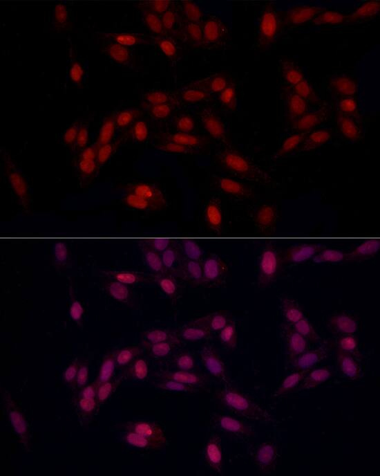SUPT16H Antibody