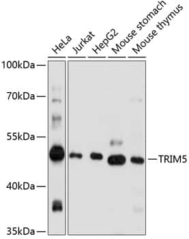 TRIM5 alpha Antibody