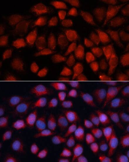 ACADM Antibody