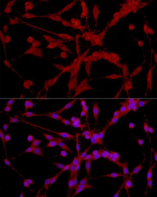 EPHX2 Antibody