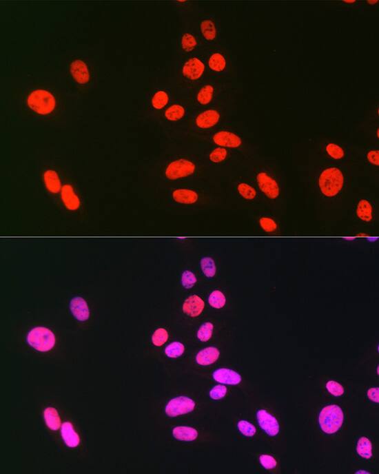hnRNP C1 + C2 Antibody