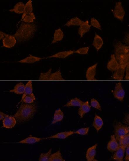 GNA11 Antibody