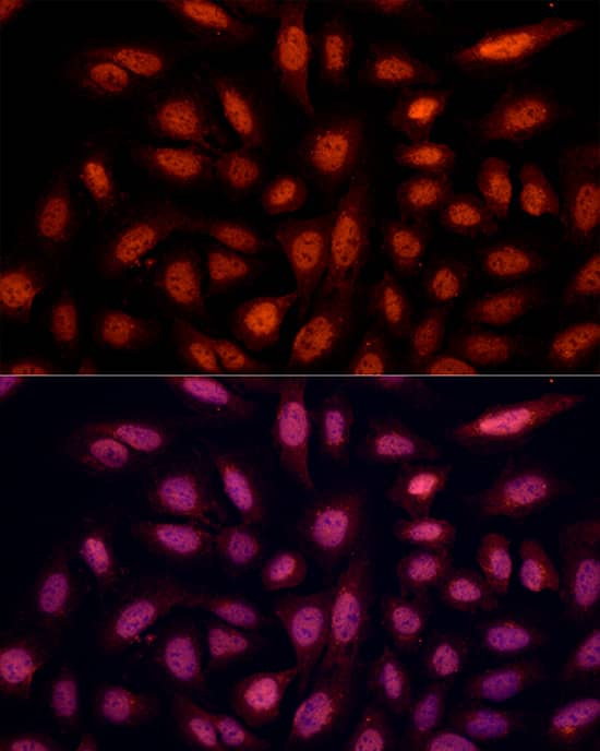 BRN3B/POU4F2 Antibody