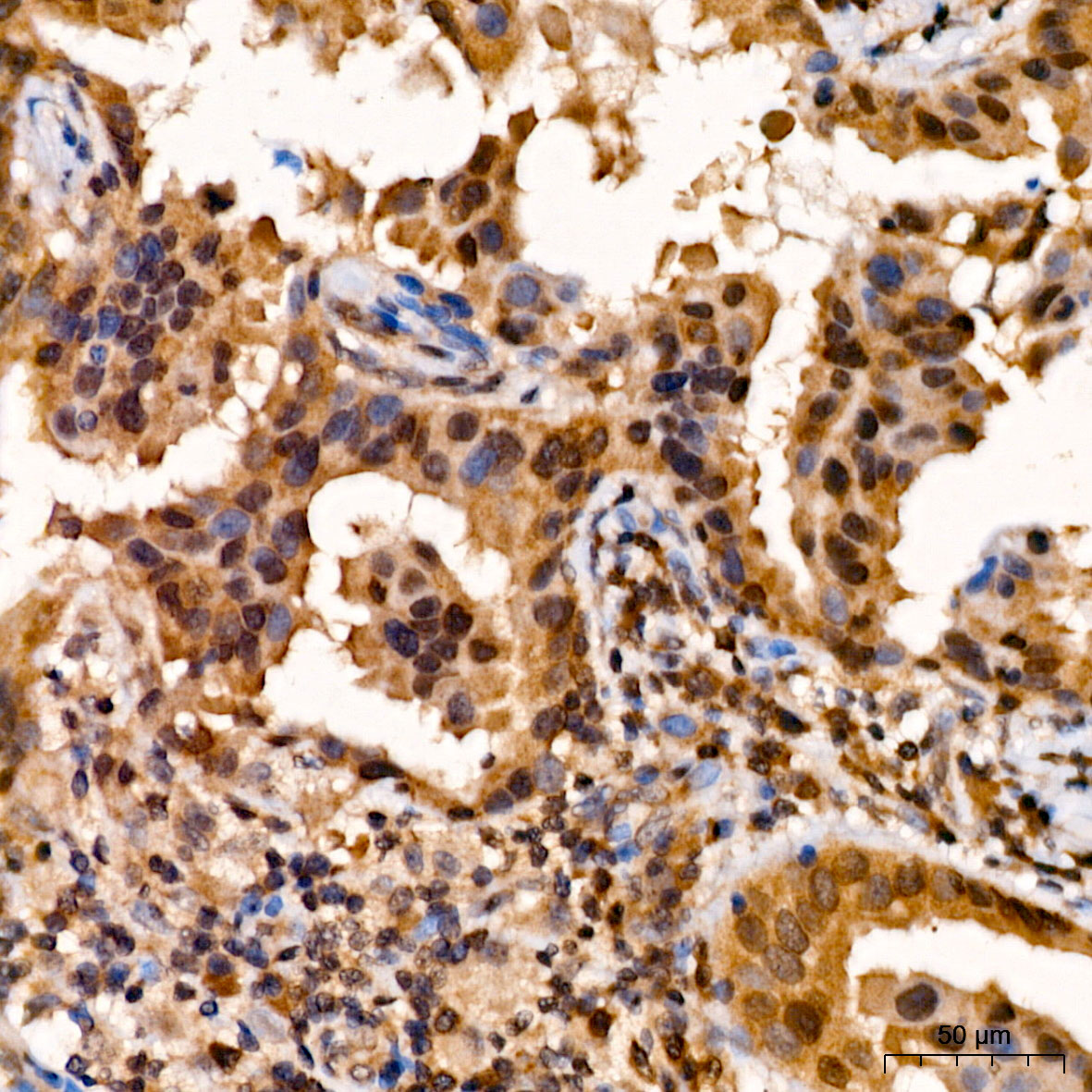 PSMB5 Antibody
