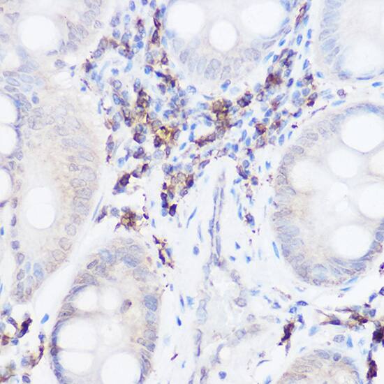 Thromboxane synthase Antibody