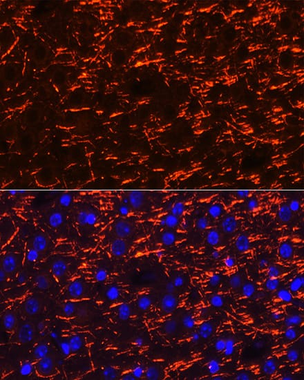 Myelin PLP Antibody