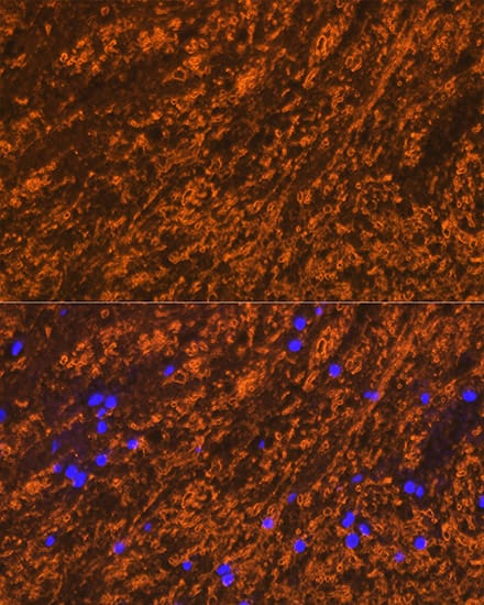 Myelin PLP Antibody