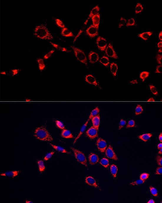 Citidine Deaminase Antibody