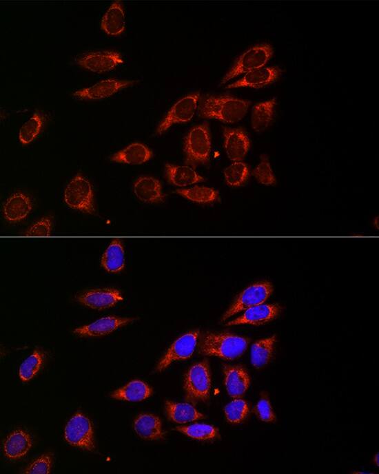 Citidine Deaminase Antibody