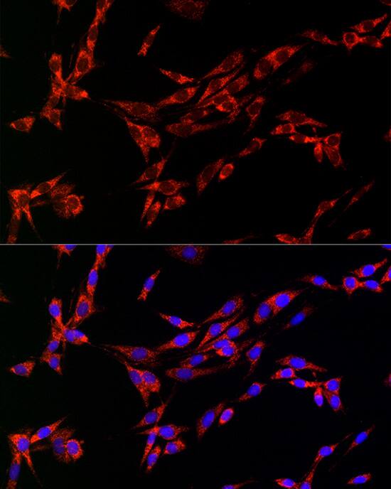 Citidine Deaminase Antibody
