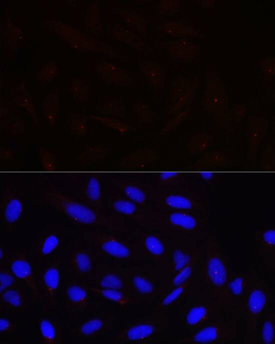 Pericentrin Antibody