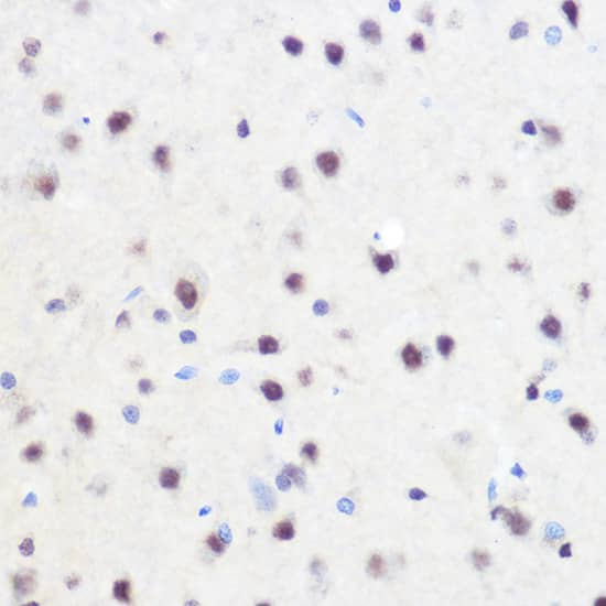 ZNF207 Antibody