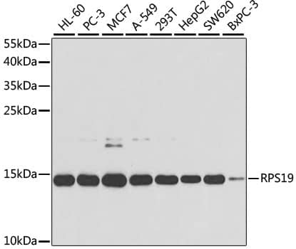 RPS19 Antibody