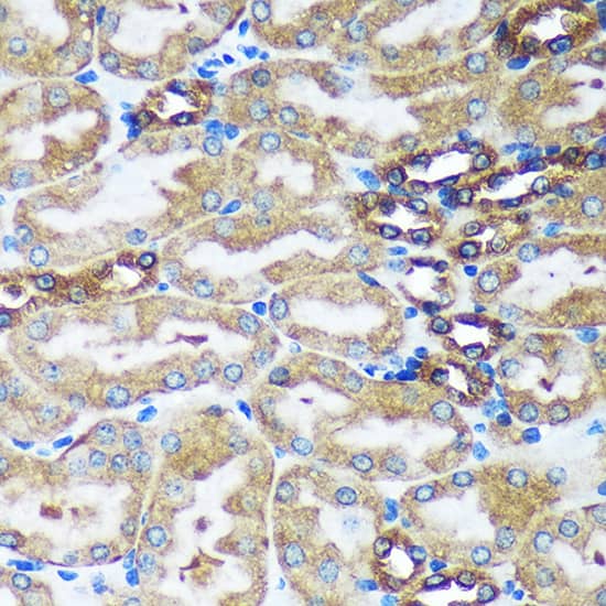 FBXO21 Antibody