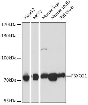 FBXO21 Antibody