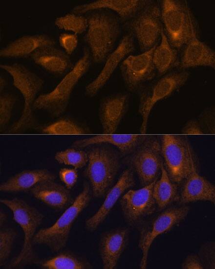 SHMT1 Antibody