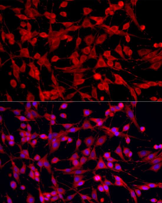 PEX5 Antibody