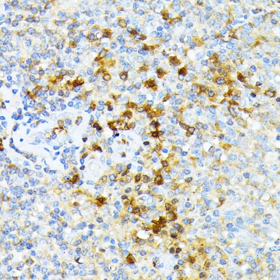 Spectrin alpha 1 Antibody