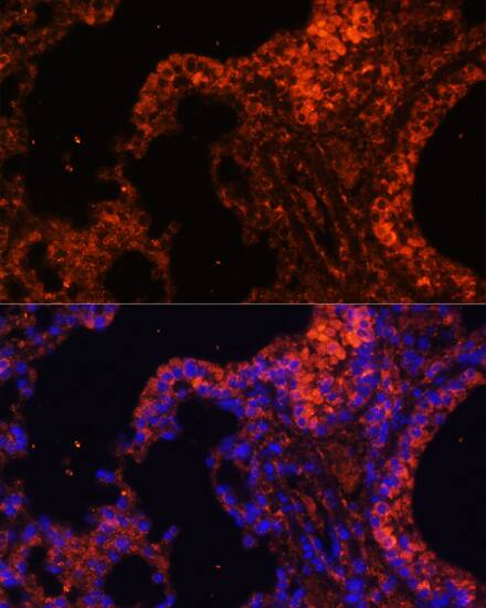 Spectrin alpha 1 Antibody