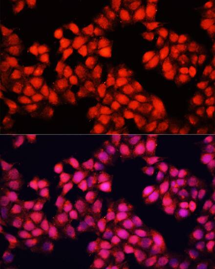 ALAD Antibody