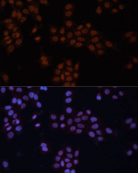 TFII-I Antibody