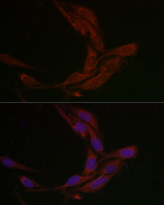 Methionine Sulfoxide Reductase A Antibody