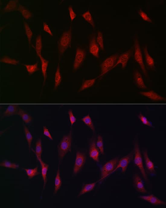 Methionine Sulfoxide Reductase A Antibody