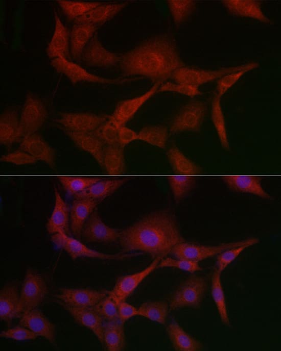 Methionine Sulfoxide Reductase A Antibody