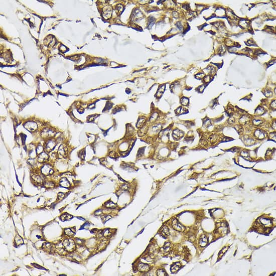 PIK3CA Antibody