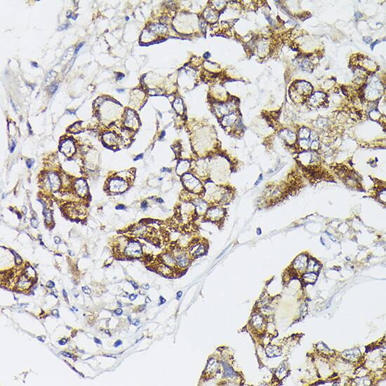 PIK3CA Antibody