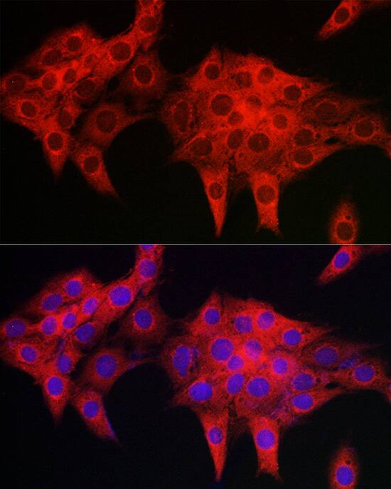 PDLIM4 Antibody