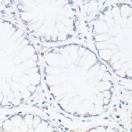 WDR77 Antibody