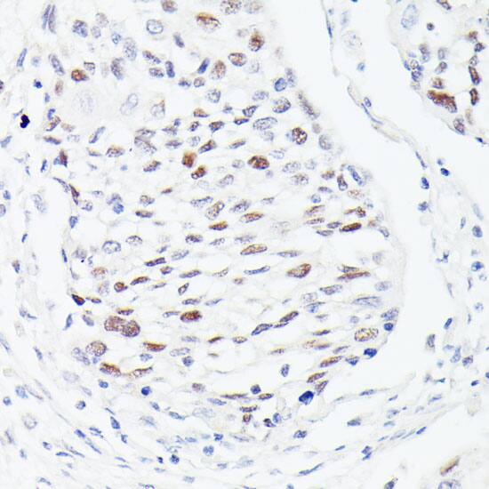 WDR77 Antibody