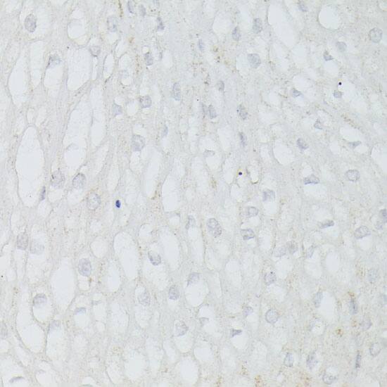 WDR77 Antibody