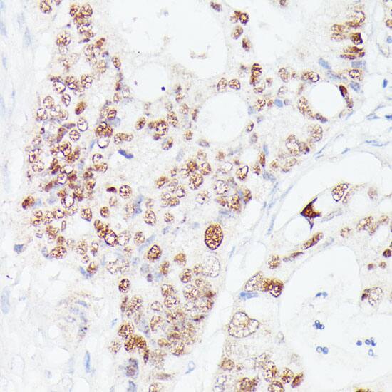 WDR77 Antibody