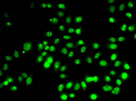 WDR77 Antibody