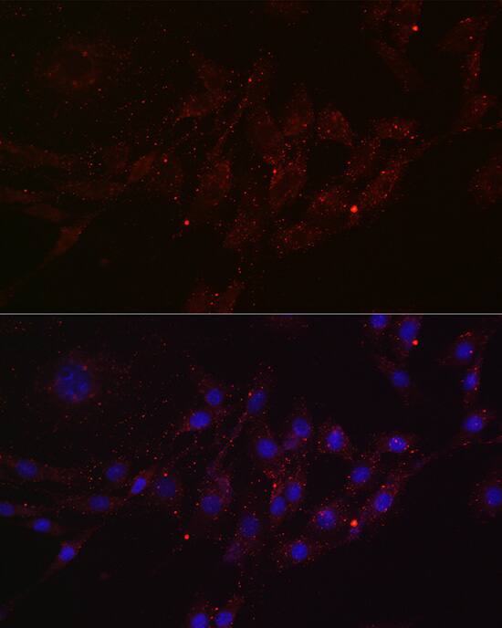 MGRN1 Antibody