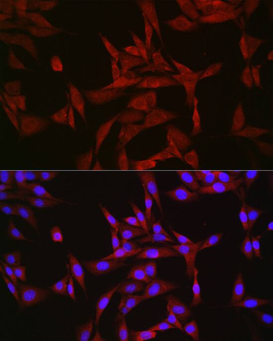 GATSL3 Antibody