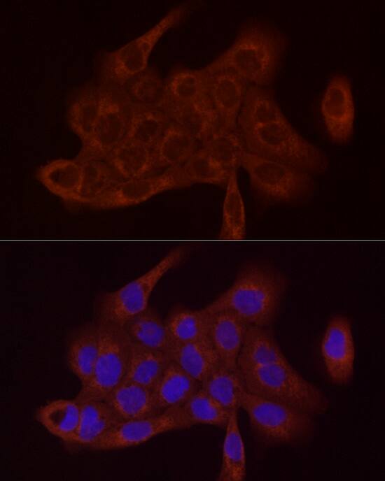 SDHC Antibody