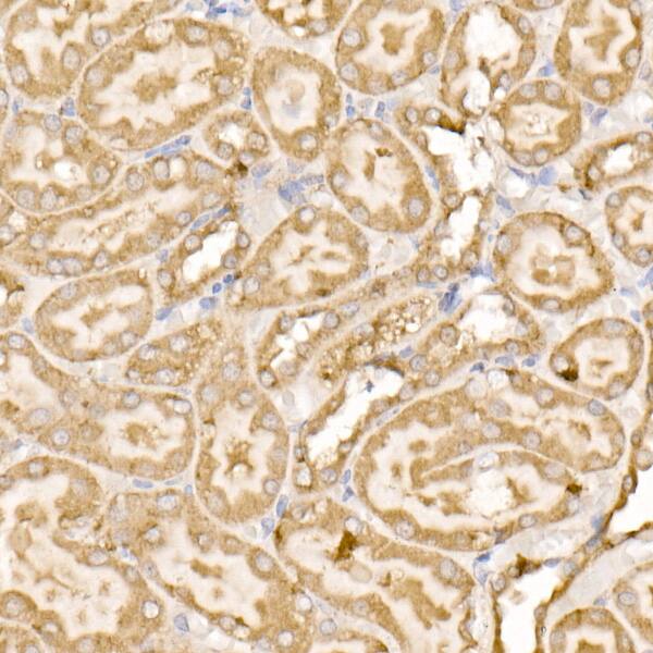 SDHC Antibody