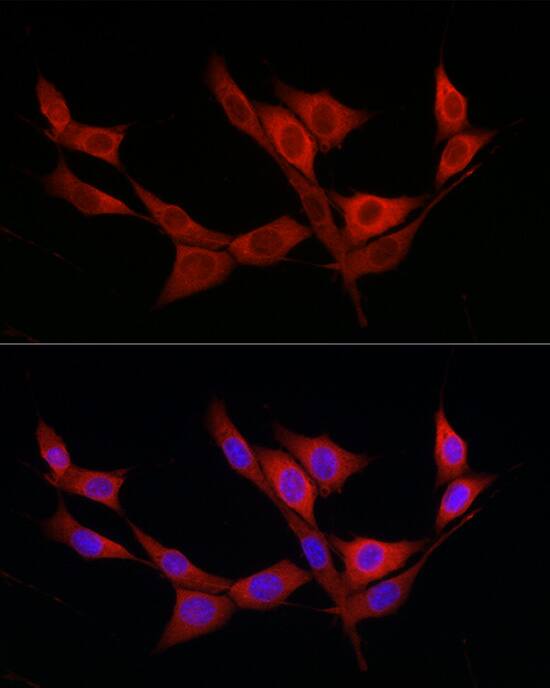 katanin-p80 Antibody