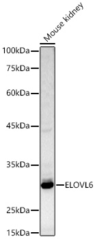 ELOVL6 Antibody