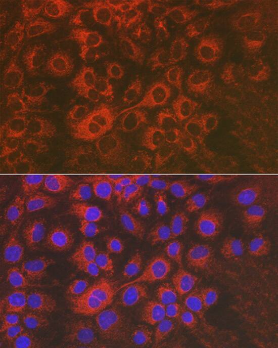 Sorbitol Dehydrogenase Antibody