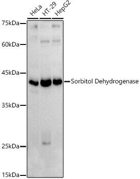 Sorbitol Dehydrogenase Antibody