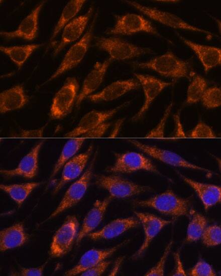 HIBADH Antibody