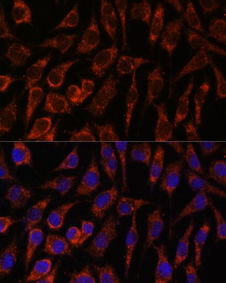 NUP210 Antibody