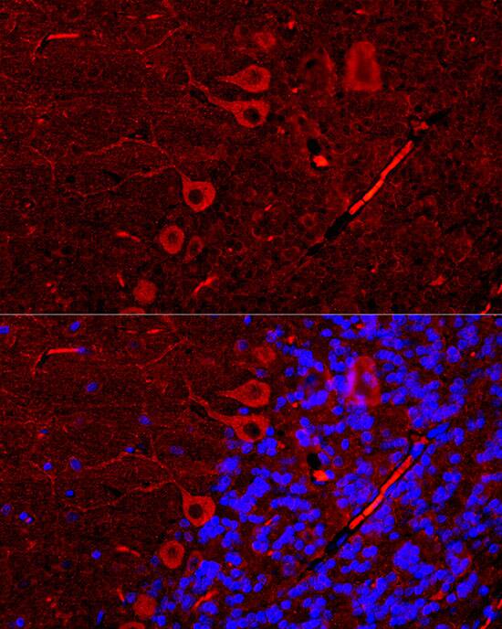 IP3R1 Antibody