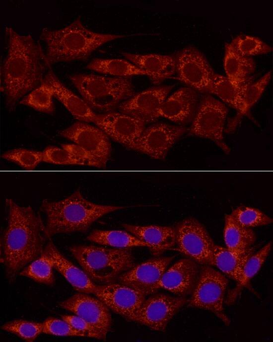 NDUFS5 Antibody